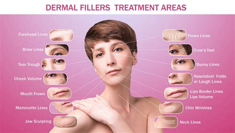 Dermal Fillers Transform Health And Beauty Clinic