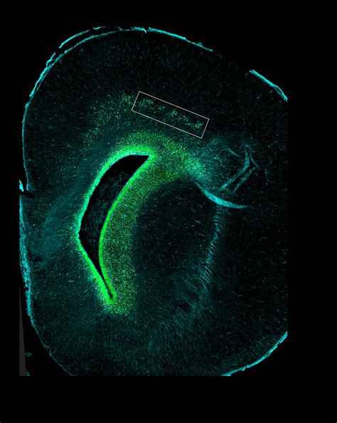 Mutant Ferret Brain Image Eurekalert Science News Releases