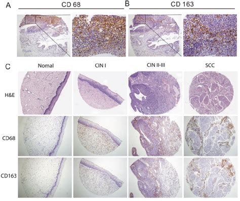 Immunohistochemical Detection Of Cd And Cd Macrophage Expression