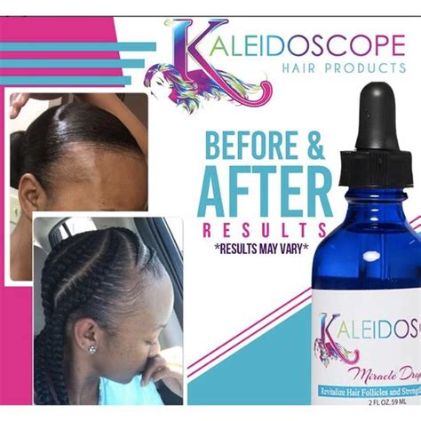 Kaleidoscope: Miracle Drops 2oz | Hair loss women, Help hair loss, Hair ...