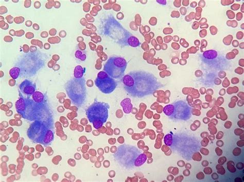 Osteoblasts Hematology Medical Laboratory Science Medical Laboratory