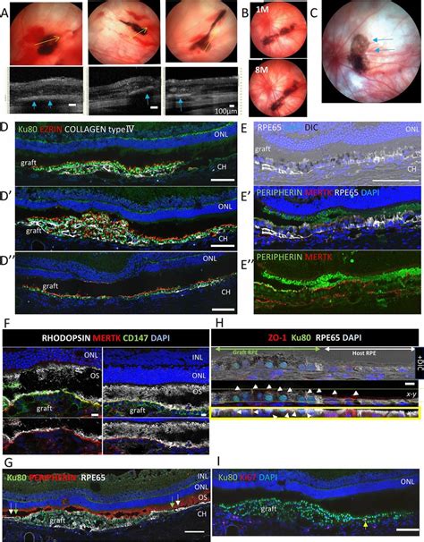 Hipsc Rpe Strip Transplantation In A Nude Rat A Three Representative