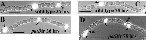 Composite Images Of Wild Type Anabaena Sp Strain Pcc Fi Laments