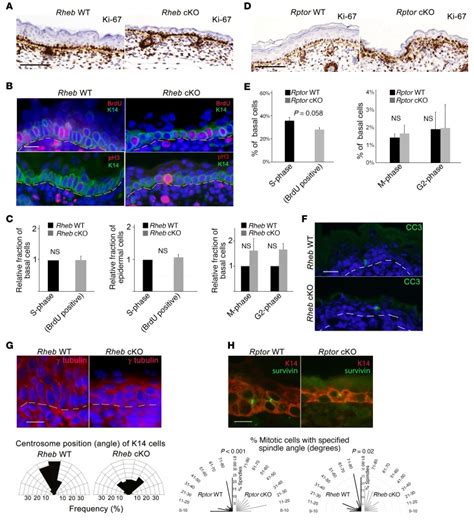 Mtorc Loss Impairs Epidermal Adhesion Via Tgf Rho Kinase Activation