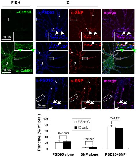 Laser Scanning Confocal Micrographs Showing Combined Fluorescence In