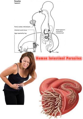 Human Intestinal Parasites Flickr Photo Sharing