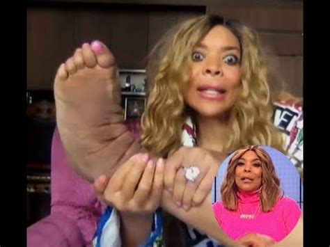 Wendy Williams Reveals Shocking Lymphedema Foot Condition Plus Life