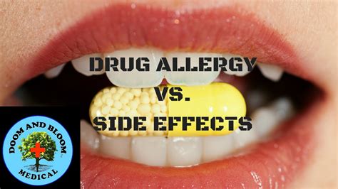 Drug Allergy vs Side Effect: How to Know - YouTube