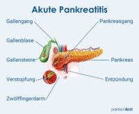 Pankreatitis Praktischarzt