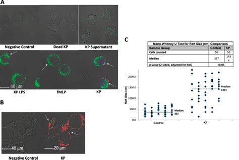 K Pneumoniae Infection Induced Lipid Raft Aggregation A Live K