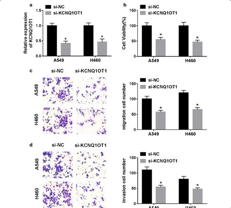 KCNQ1OT1 Knockdown Inhibited Proliferation Migration And Invasion Of