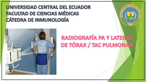 SOLUTION Radiograf A Ap Y Lateral De T Rax Tomografia Pulmonar Studypool