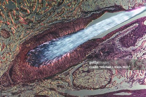 Close Up Of Hair Growing In Follicle High Res Stock Photo Getty Images