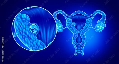 Implanted human embryo concept and successful pregnancy implantation in ...