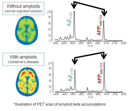 Amyloid Ms Research Development Shimadzu Corporation