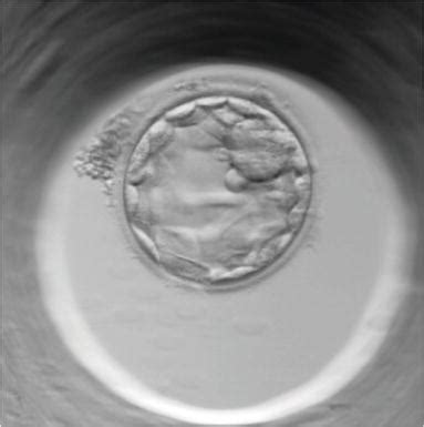 Human Blastocyst Formation and Development | IntechOpen