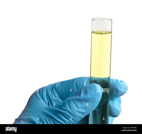 Doctor Holding Test Tube With Urine Sample For Analysis On White