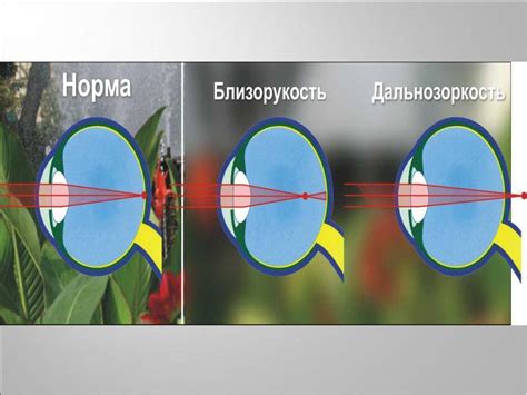 Близорукость и дальнозоркость одновременно, может ли такое быть, как ...