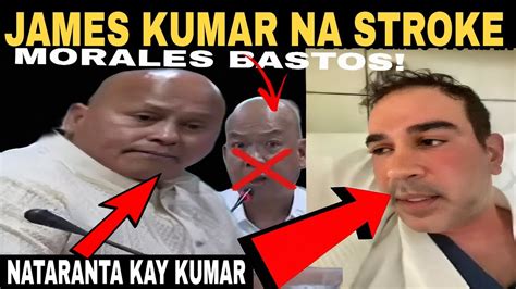 James Kumar Na Stroke Sa Hearing Ni Bato Pdea Leaks Youtube