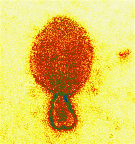 Nipah virus transmission, outbreak, symptoms, diagnosis & treatment