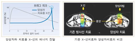 양성자 Vs 중입자 암 치료 장·단점 알고 선택하세요