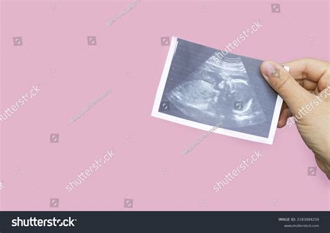 59 Naked Women Laying On Tummy Images Stock Photos Vectors Shutterstock