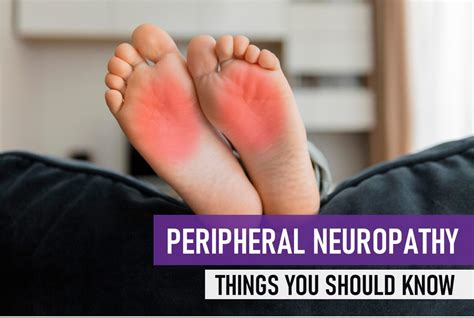 Peripheral Neuropathy Things You Should Know