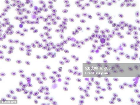 39 40x Magnification Stock Photos, High-Res Pictures, and Images ...