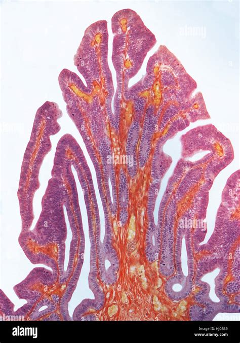 Fallopian Tube Light Micrograph Lm Of A Section Through A Fallopian Tube Or Oviduct The