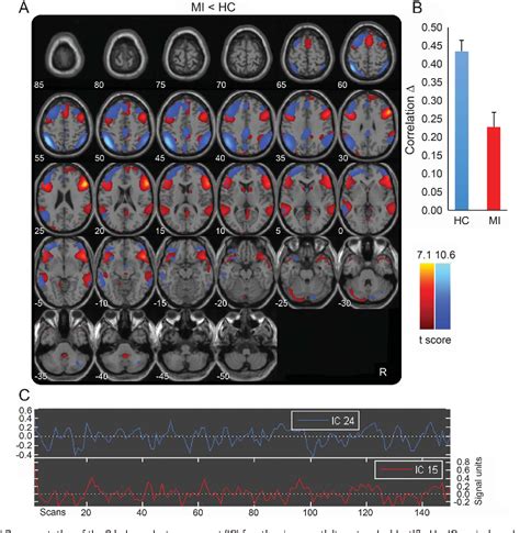 Figure From Thalamo Cortical Network Activity During Spontaneous