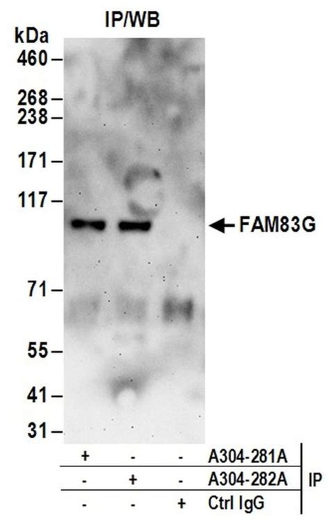 Fam83g Polyclonal Antibody A304 281a