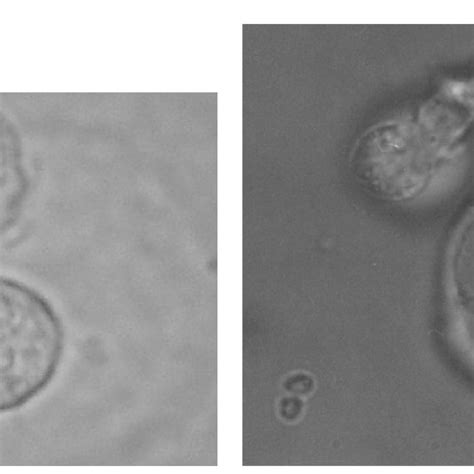 exit mechanisms  intracellular parasites   host cells