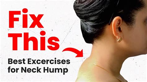 How To Fix A Neck Hump At Home Fast By Yogayug Youtube