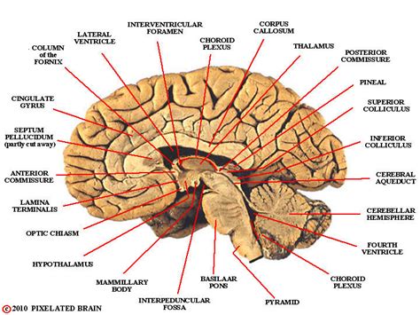 Pixelated Brain Landmarks Midsagittal View Cerebral Hemisphere