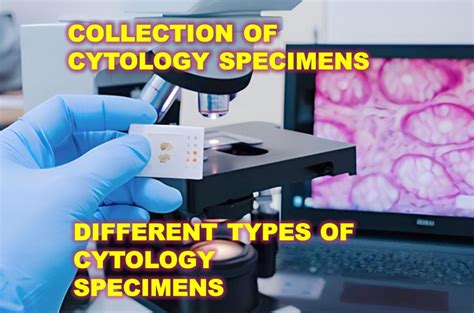 COLLECTION TYPES OF CYTOLOGY SPECIMENS