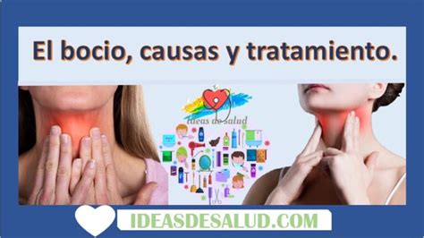 El Bocio Causas Y Tratamiento Ideas De Salud