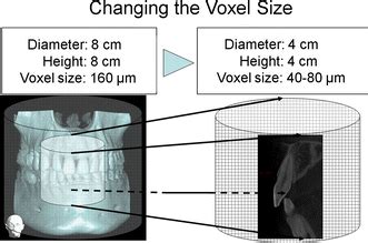 The Effect Of Voxel Size On Image Reconstruction In Cone Beam Computed