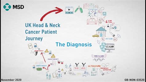 Head And Neck Cancer Steps To Confirm Diagnosis What To Expect At