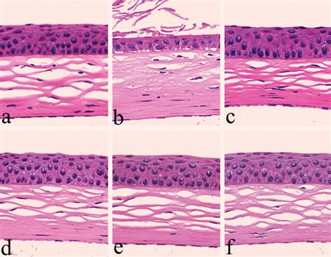 Corneal Epithelium Histology