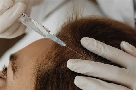 Platelet Rich Plasma Prp Therapy Aka Prp Hair Restoration