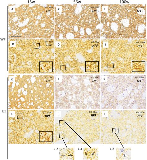 Immunohistochemical Analysis Of Dat In The Striatum Of Wt Control Mice