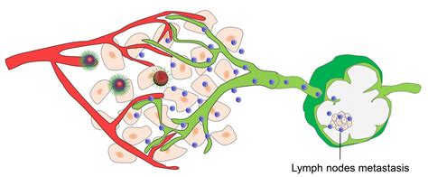 Nanoparticle Therapy Targets Lymph Node Metastases 2019 Wiley