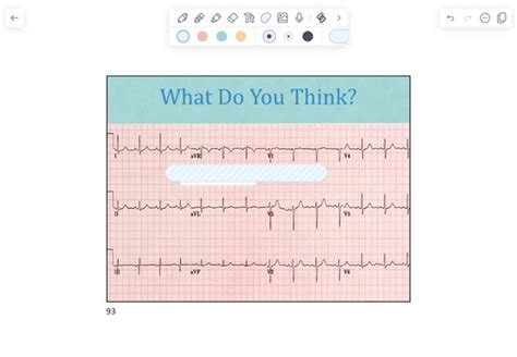 Ekg Practice Terms Definitions Week Medicine Study Flashcards