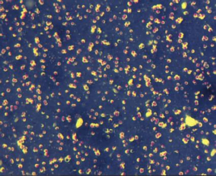 Nt Cp Isolate Of S Aureus Cp Negative By Genotyping And Serotyping