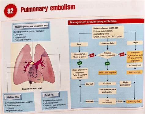 Diagram Of Pulmonary Embolism Quizlet