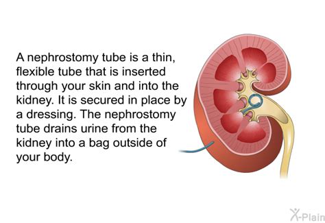 PatEdu.com : Nephrostomy Tube Care