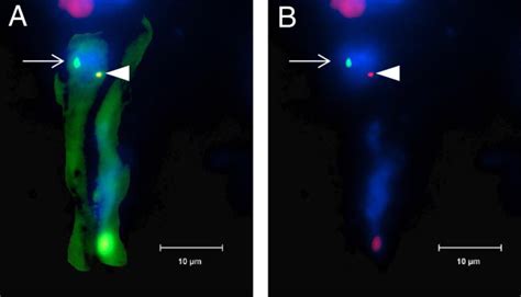 Y chromosome-positive nuclei in endothelial cell. Immunofluorescent... | Download Scientific Diagram