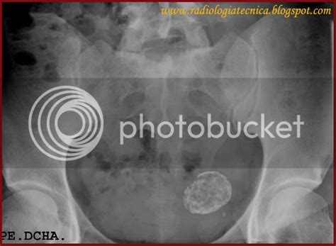 Técnicas Radiológicas y Avances RX ABDOMEN