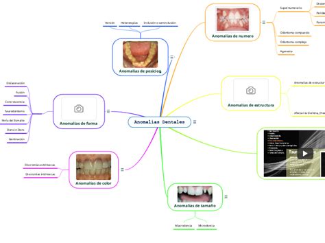 Anomal As Dentales Mind Map