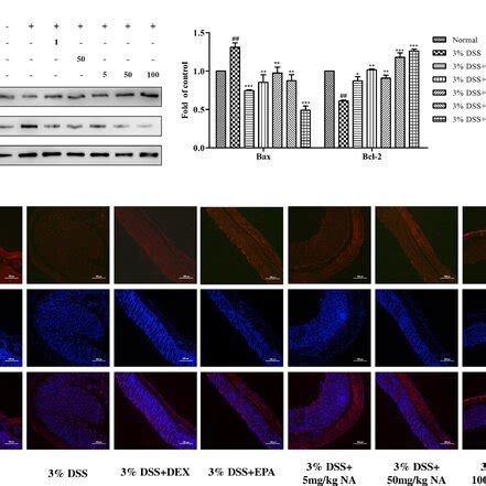 Nervonic Acid Attenuated Dss Induced Apoptosis And Deletion Of Tight